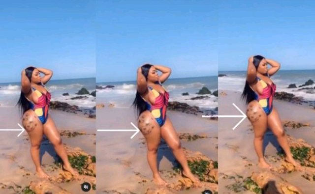 Moesha Boduong Scares Her Fans With Her ‘Rotten’ Buttocks