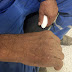 Objetos cortantes em sacos de lixo provocam acidentes em garis de Ruy Barbosa