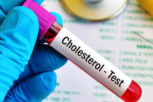 Cholesterol Testing Services Market