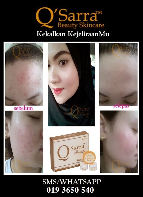 Q'SARRA BEAUTY SKINCARE BERKESAN!