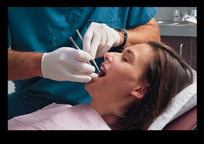 Răng khôn mọc lệch vào trong có nguy hiểm không?
