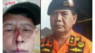 Oknum Ormas Pemukulan Wartawan dugaan dibebaskan, Akan Lapor Ke Propam dan Paminal Kinerga Polres Majalengka