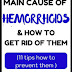 Hemorrhoids – an unpleasant occurrence with severe symptoms 