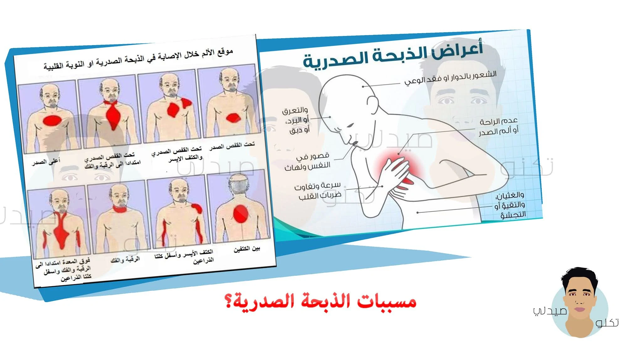 ماهي اسباب الذبحة الصدرية؟