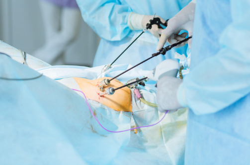  Laparoscopy