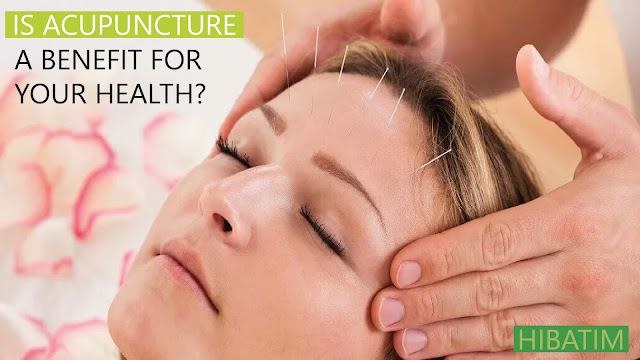 Is Acupuncture A Benefit For Your Health?