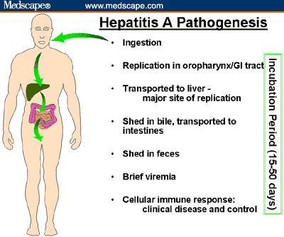 Hepatitis