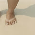 Effective Home Remedies For Sunburn Relief
