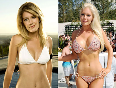 heidi montag before. heidi montag before after.