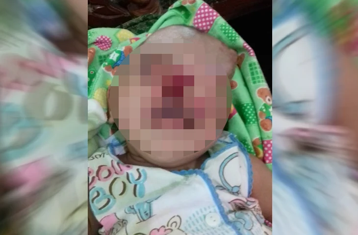 Lahir dengan Tidak Sempurna, Bayi Mungil di Pamekasan Ini Butuh Biaya Operasi