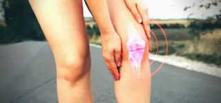 Weight Loss for Knee Osteoarthritis : athletic lady who fell and hurt her knee while running.