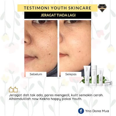 Testimoni-Youth-Skincare