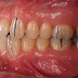 Clinical Dental Photography