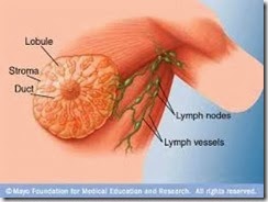breast lymph node1