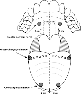 Chorda tympani