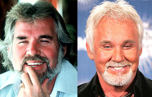 kenny rogers before and after