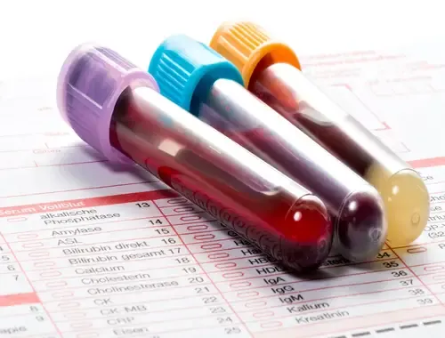 The Ultimate Cancer Blood Test: Decoding Blood Cancer Markers