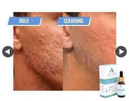 Testimoni azanis scar serum