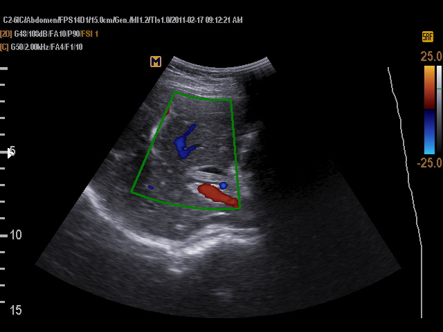 common bile duct. AND COMMON BILE DUCT