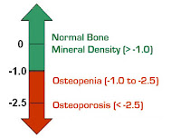 Osteoporose