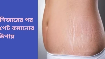 সিজারের পর পেট কমানোর উপায়