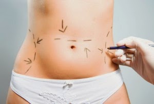 http://cosmetic-surgery-chennai.com/Bariatric-weight-reduction-surgery-liposuction.php