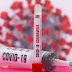 Covid-19: sequenciamento genético identifica 19 variantes em circulação na Paraíba