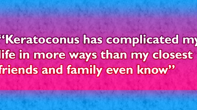 Keratoconus: Why I Squint and Struggle!