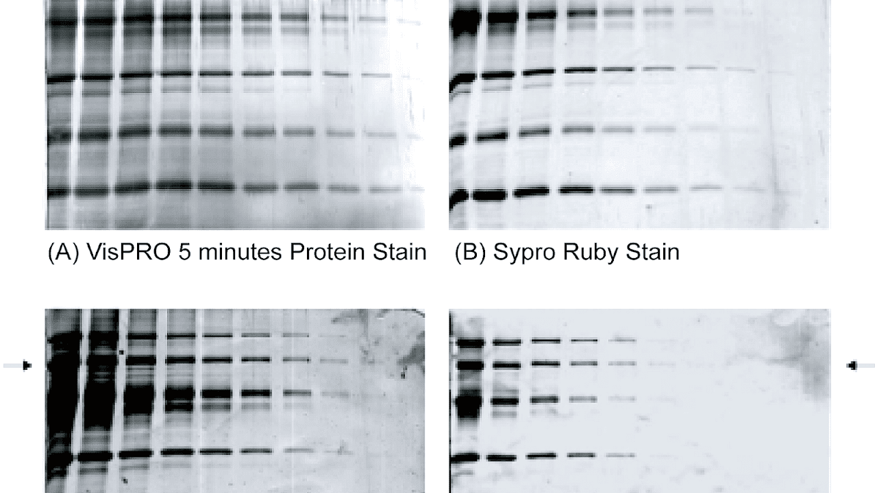 Silver Stain Sensitivity