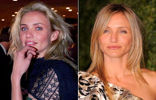 Cameron Diaz  befor and after plastic surgery