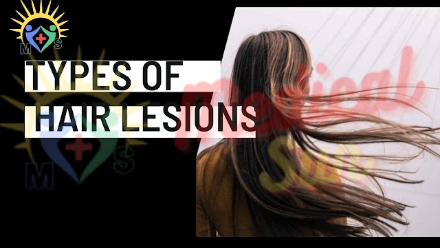 Types of hair lesions