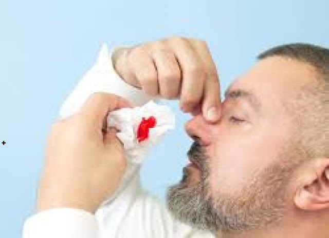 Dream of Bleeding nose meaning in Islam