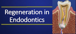 Regeneration in Endodontics, Regenerative endodontics