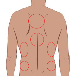 등 부위별 통증 부위들