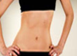 Tummy Tuck before and after pictures