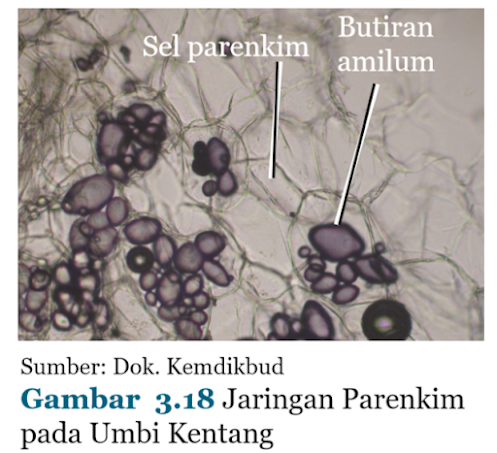 Gambar Jaringan Parenkim pada Umbi Kentang