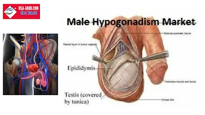 What is Male Hypogonadism?