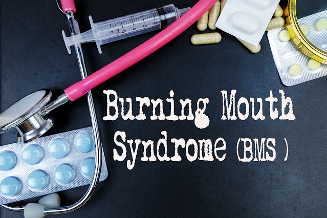 burning mouth syndrome