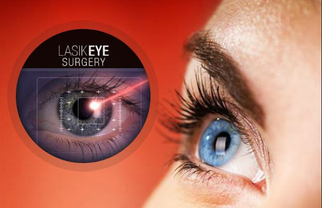 Lasik Laser in Delhi