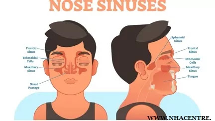 How to cure Sinus.