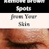 Famous Dermatologist Revealed Remove Brown Spots On Face And Skin With This Simple Trick