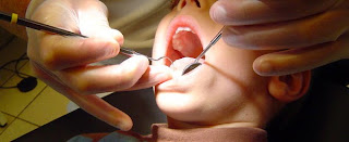  Dentist phobia