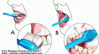 Cara Menggosok Gigi 