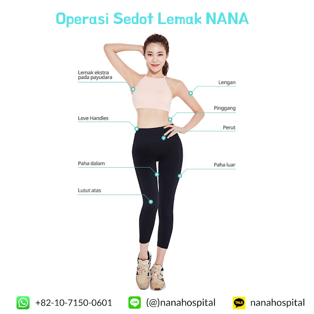 operasi sedot lemak, liposuction, sedot lemak badan, sedot lemak perut, sedot lemak mini, sedot lemak full, badan langsing, badan ideal, olahraga, diet, makanan sehat, operasi plastik korea