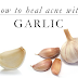 Healing Acne with Garlic