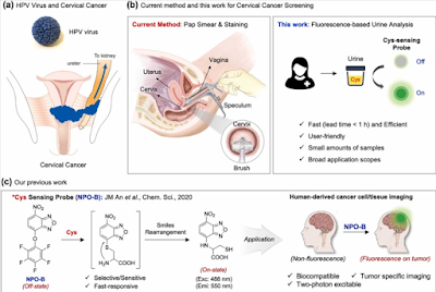 Cervical Cancer
