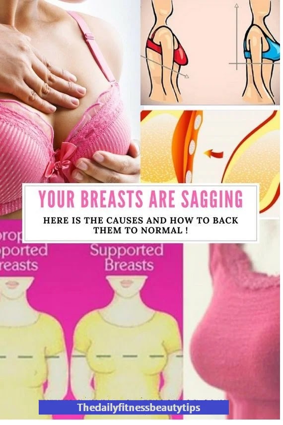 saggy breast treatment