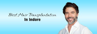 hair transplantation in Indore