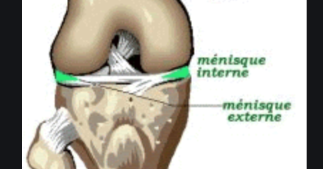 Un médecin du sport vous informe: Le genou méniscal