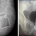 इन 9 X-Ray रिपोर्ट्स को देख हो जाएंगे आप हैरान, किसी में दिखा बल्ब, तो किसी में बैंगन